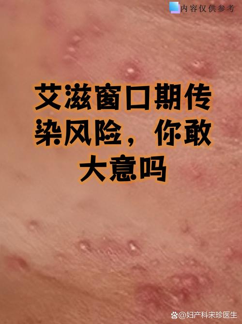 西安本轮疫情是什么病毒？德尔塔变异株传染性如何